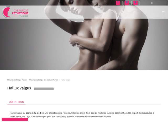 Chirurgie hallux valgus en Tunisie