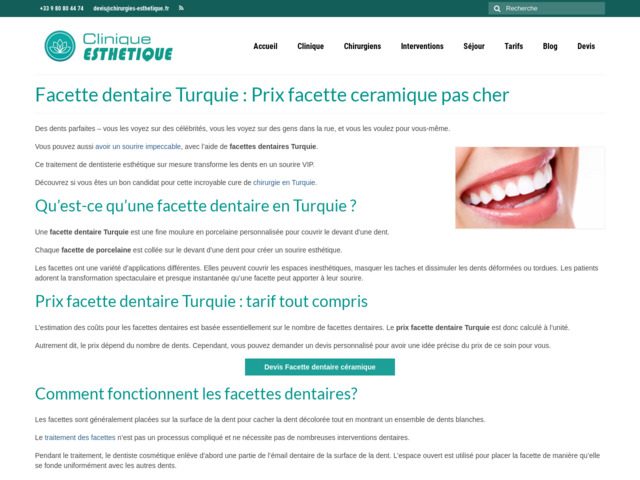 Facette dentaire Turquie