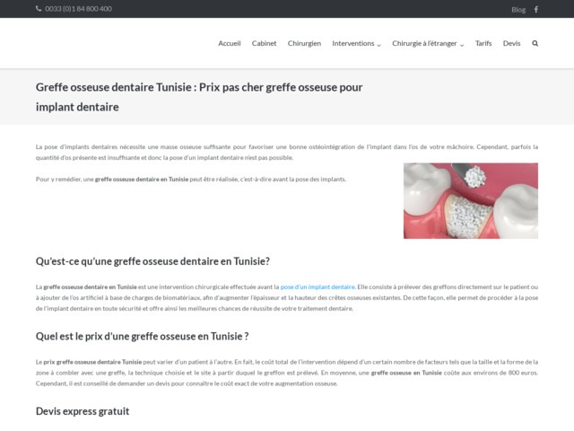 Greffe osseuse dentaire Tunisie