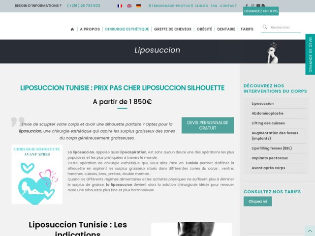 Liposuccion Tunisie
