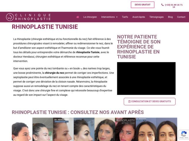 La rhinoplastie en tunisie avec dr hendaoui
