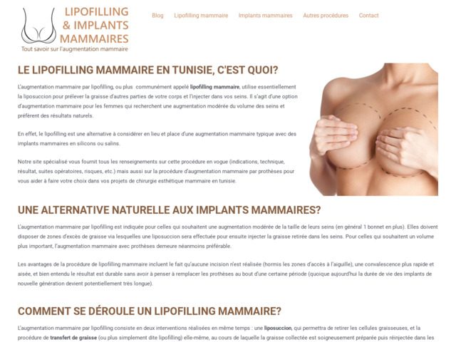 Chirurgie esthétique mammaires en tunisie