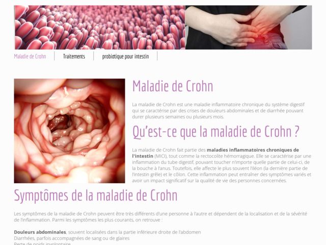 Informations sur la maladie de crohn