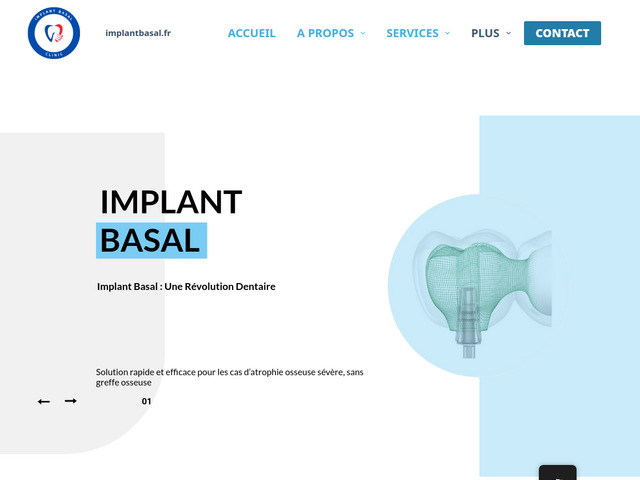 Implant basal clinic