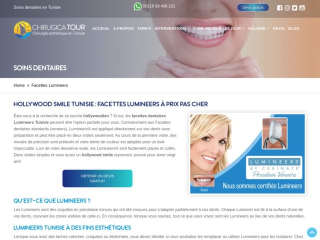 Facettes Lumineers Tunisie