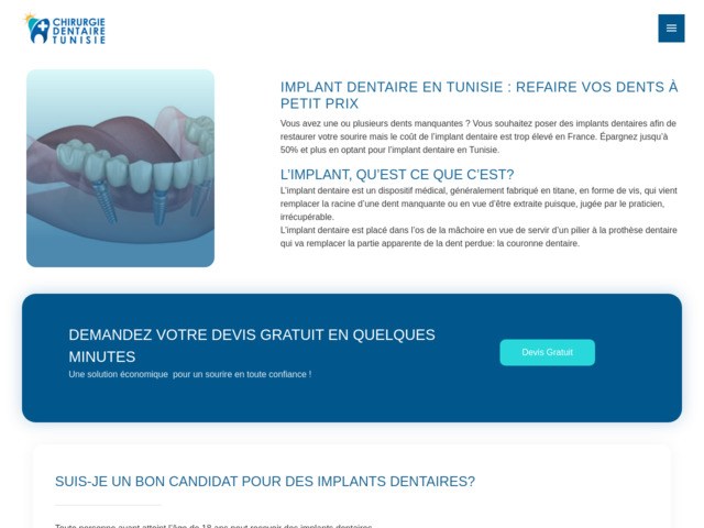 Prix des implants et des facettes dentaires en tunisie ?