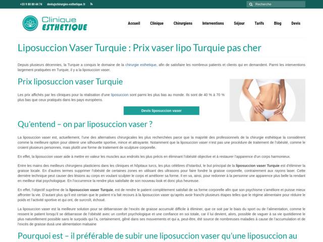 Liposuccion vaser turquie
