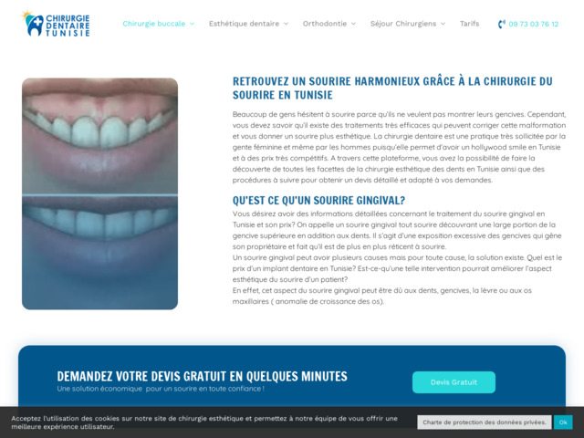 A quel prix des facettes dentaires en Tunisie ?