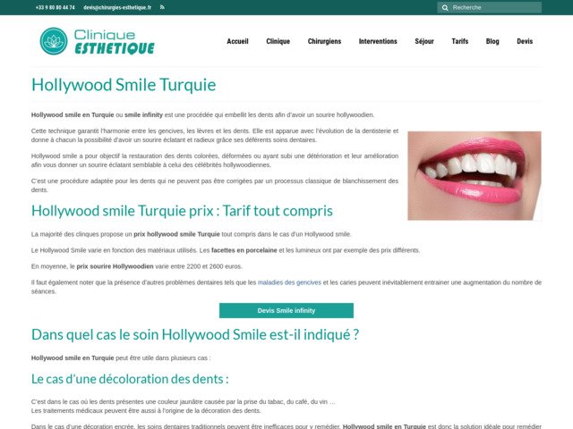 Hollywood smile Turquie