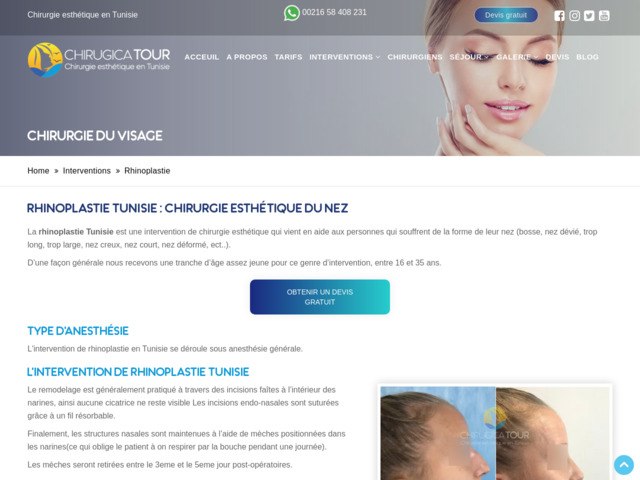 Rhinoplastie Tunisie