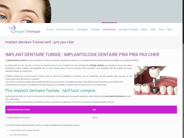 Implant dentaire tunisie