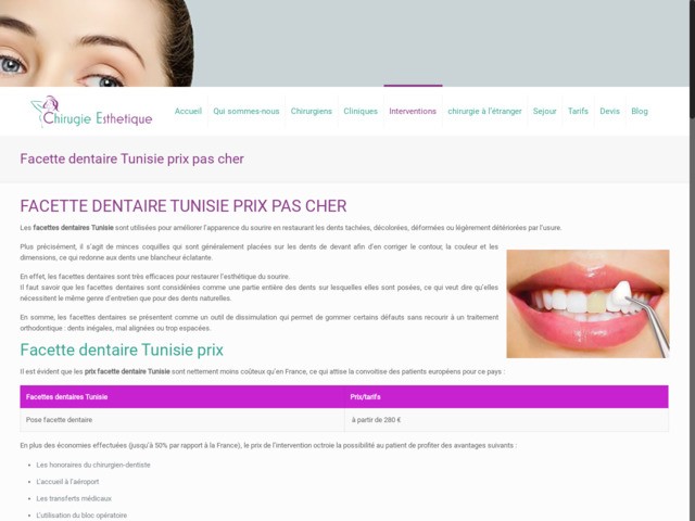 Facette dentaire tunisie