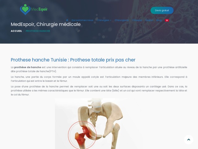 Prothèse hanche Tunisie