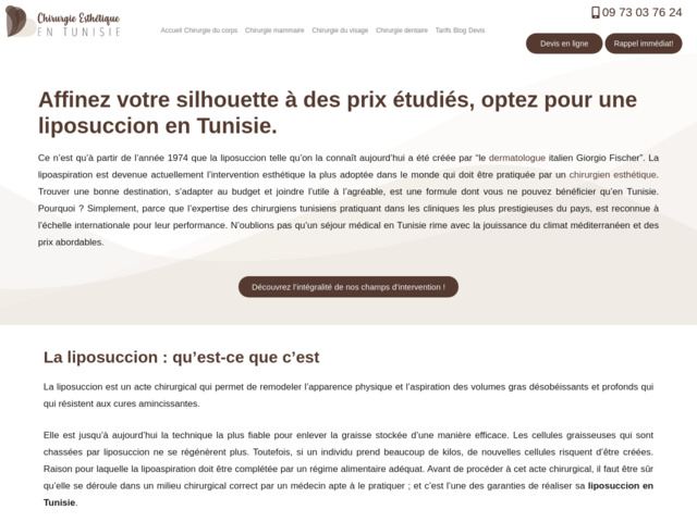 Comment obtenir le Hollywood Smile en Tunisie avec des facettes dentaires ?