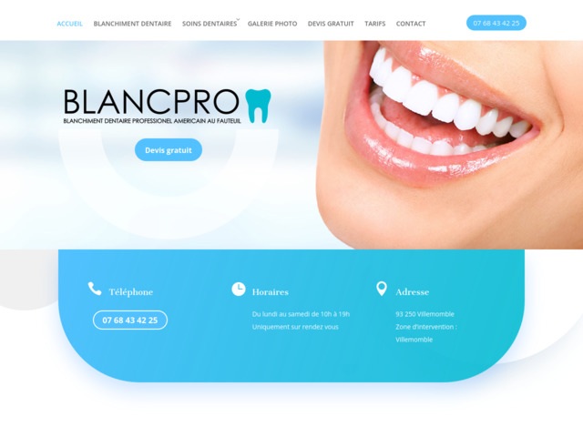 Correction de sourire gingival à villemomble