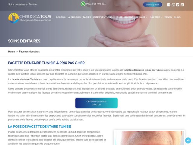 Facettes dentaires en tunisie