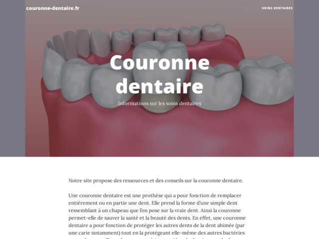 Infos sur la couronne dentaire