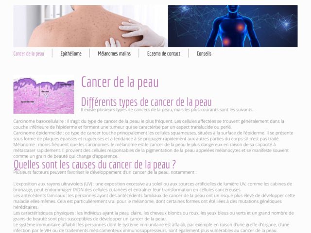 Comment se manifeste le cancer de la peau ?