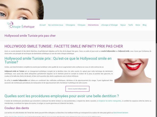 Hollywood smile Tunisie prix