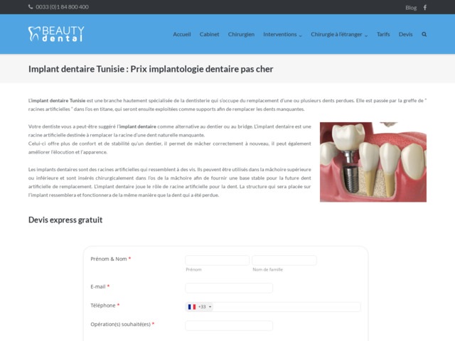 Implant dentaire tunisie